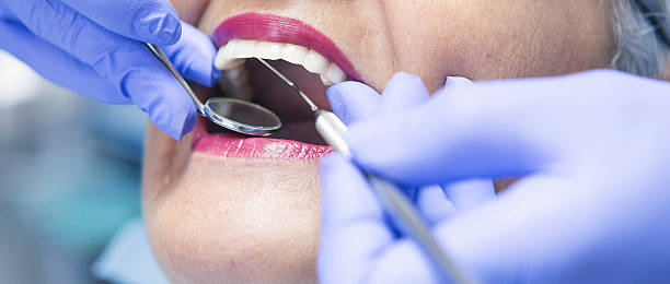 Best Emergency Dental Care for Sports Injuries in Lyndhurst, VA